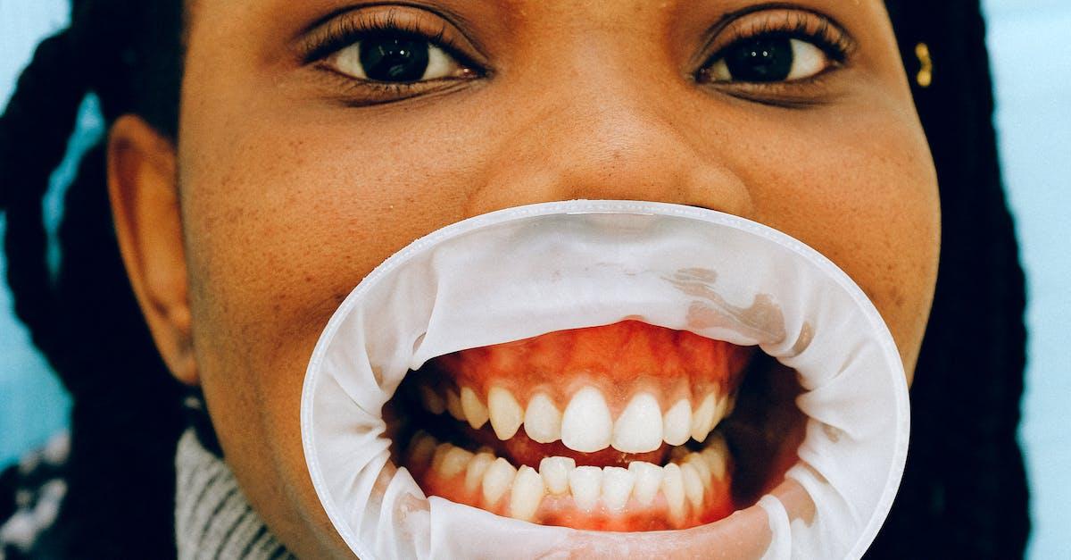 Komplet guide til at passe optimalt på dine tænder